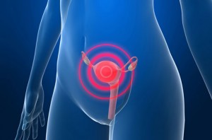 Cáncer-cervicouterino-UNAM