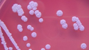 56976171c4618870568b45b7