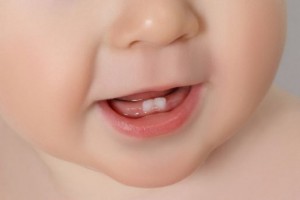 bigstock-closeup-of-a-baby-teeth-78604397-514x342